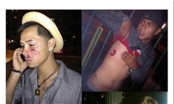 پلیس لس‌آنجلس با باتوم از معترضان طرفدار آزادی بیان استقبال کرد+عکس