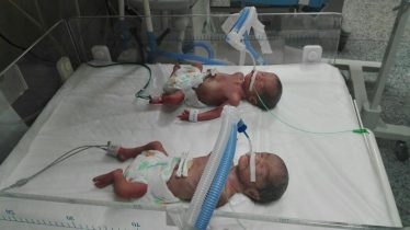 سه قلویی که در رفسنجان ۶ ماهه به دنیا آمد / عکس