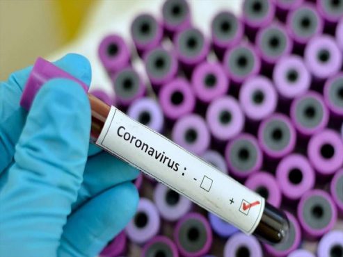 آخرین وضعیت ویروس کرونا در رفسنجان: ۲۳ مبتلا، ۴ مرگ و ۱۰ بهبود یافته